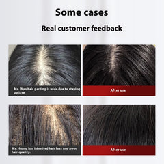 Rubbing Hair Comb Scalp Electric Massage Comb Red Light Anti-density Hair Growth Device